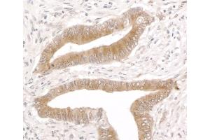 Immunohistochemistry (IHC) image for anti-Reticulocalbin 1, EF-Hand Calcium Binding Domain (RCN1) (AA 1-75) antibody (ABIN7453447) (RCN1 antibody  (AA 1-75))