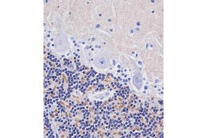 ABIN653897 staining H in human cerebellum tissue sections by Immunohistochemistry (IHC-P - paraformaldehyde-fixed, paraffin-embedded sections). (AMH antibody  (AA 424-451))