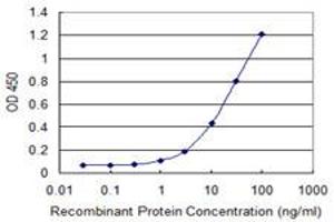 Detection limit for recombinant GST tagged USP45 is 0. (USP45 antibody  (AA 106-196))
