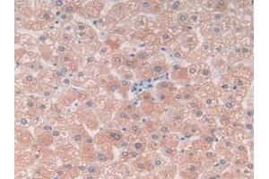 IHC-P analysis of Human Liver Tissue, with DAB staining. (C9 antibody  (AA 22-265))