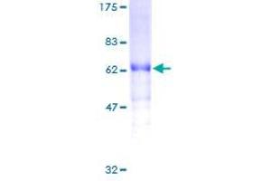 Image no. 1 for C-Fos Induced Growth Factor (Vascular Endothelial Growth Factor D) (Figf) (AA 1-354) protein (GST tag) (ABIN1354094) (VEGFD Protein (AA 1-354) (GST tag))