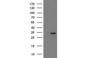 HEK293T cells were transfected with the pCMV6-ENTRY control (Left lane) or pCMV6-ENTRY HDHD2 (Right lane) cDNA for 48 hrs and lysed. (HDHD2 antibody)