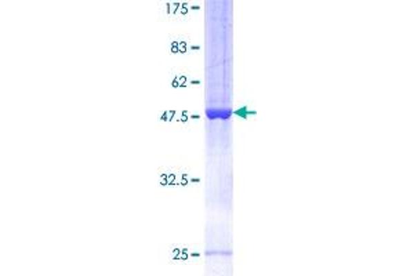 ARFRP1 Protein (AA 1-201) (GST tag)