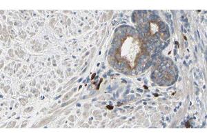 ABIN6277164 at 1/100 staining Human prostate tissue by IHC-P. (Phospholipase C gamma 2 antibody  (Internal Region))