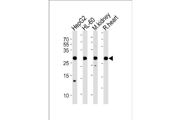 ATP5F1 anticorps  (AA 161-195)