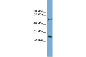 WB Suggested Anti-ETHE1  Antibody Titration: 0. (ETHE1 antibody  (Middle Region))