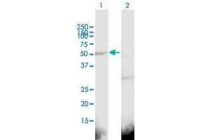 Western Blot analysis of KRT16 expression in transfected 293T cell line by KRT16 MaxPab polyclonal antibody. (KRT16 antibody  (AA 1-473))