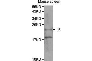 Western blot analysis of extracts of mouse spleen tissue, using IL6 antibody.