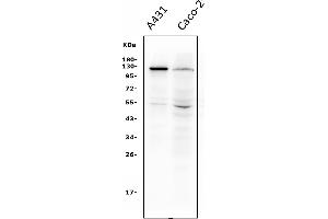 Western blot analysis of P cadherin/CDH3 using anti-P cadherin/CDH3 antibody (ABIN7599888).