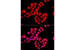 Immunofluorescence analysis of A549 cell using CAMK1D antibody. (CAMK1D antibody)