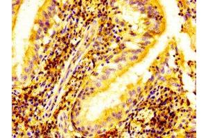IHC image of ABIN7152068 diluted at 1:500 and staining in paraffin-embedded human lung tissue performed on a Leica BondTM system. (ELK3 antibody  (AA 163-300))