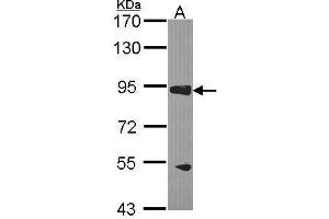 WB Image Sample (30 ug of whole cell lysate) A: H1299 7. (RASA3 antibody  (C-Term))