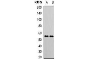 Western blot analysis of IRF3 (pS385) expression in HEK293T (A), HT29 (B) whole cell lysates. (IRF3 antibody  (C-Term, pSer385))