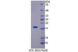 Image no. 1 for Interleukin 1 Family, Member 10 (Theta) (IL1F10) (AA 15-152) protein (His tag) (ABIN6238529) (IL1F10 Protein (AA 15-152) (His tag))