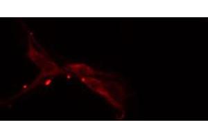 ABIN6274281 staining HepG2 cells by IF/ICC. (HNRNPF antibody  (N-Term))