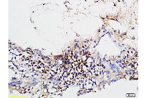 Formalin-fixed and paraffin embedded rabbit sclera tissue labeled with Rabbit Anti-CD31/PECAM-1 Polyclonal Antibody (ABIN726140) at 1:600 followed by conjugation to the secondary antibody and DAB staining. (CD31 antibody  (AA 681-738))