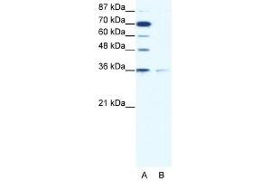 ZNF326 antibody (20R-1071) used at 0. (ZNF326 antibody  (C-Term))