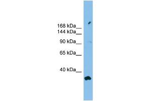 WB Suggested Anti-PACS2 Antibody Titration: 0. (PACS2 antibody  (Middle Region))