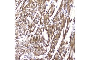 IHC analysis of Cardiac FABP using anti-Cardiac FABP antibody (ABIN5693024).