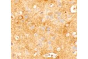 Immunohistochemistry of KCNK12 in mouse brain tissue with KCNK12 KCNK12 antibody at 5 ug/mL.