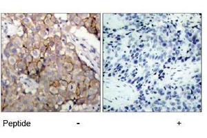 Image no. 1 for anti-Epidermal Growth Factor Receptor (EGFR) (Tyr1092) antibody (ABIN197231) (EGFR antibody  (Tyr1092))