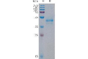 Artemin (ARTN) (AA 108-220) protein (Fc Tag)