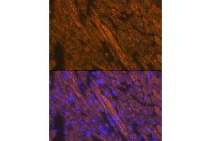 Immunofluorescence analysis of mouse heart cells using Cardiac troponin T (TNNT2) Rabbit pAb (ABIN3021485, ABIN3021486, ABIN3021487 and ABIN6215132) at dilution of 1:100 (40x lens). (Cardiac Troponin T2 antibody  (AA 1-120))