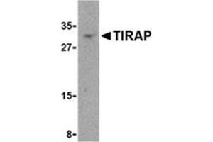 Western blot analysis of TIRAP in MCF-7 cell lysate with this product at 4 μg/ml. (TIRAP antibody  (Center))