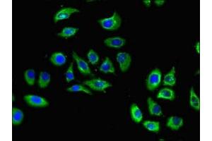Immunofluorescent analysis of A549 cells using ABIN7170577 at dilution of 1:100 and Alexa Fluor 488-congugated AffiniPure Goat Anti-Rabbit IgG(H+L) (S1PR5 antibody  (AA 309-398))