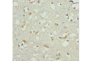 Immunohistochemistry of paraffin-embedded human brain tissue using ABIN7151540 at dilution of 1:100 (EEF1B2 antibody  (AA 1-225))