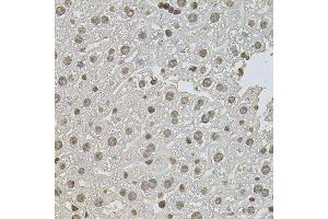 Immunohistochemistry of paraffin-embedded mouse liver using ZNF408 antibody.