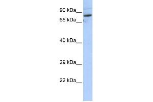 SPTLC2 antibody used at 1 ug/ml to detect target protein. (SPTLC2 antibody  (N-Term))