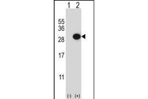 Western blot analysis of CTHRC1 (arrow) using rabbit polyclonal CTHRC1 Antibody (N-term) (ABIN652724 and ABIN2842480).