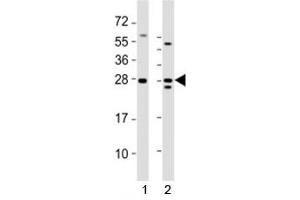 Western Blotting (WB) image for anti-Lin-28 Homolog A (C. Elegans) (LIN28A) (AA 177-210), (C-Term) antibody (ABIN3031623)