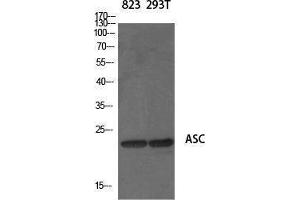Western Blotting (WB) image for anti-Steroid Sulfatase (STS) (N-Term) antibody (ABIN3183398) (STS antibody  (N-Term))