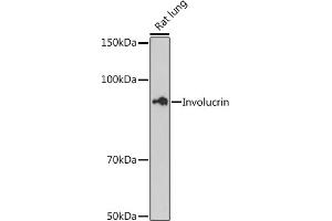 Western blot analysis of extracts of Rat lung cells, using Involucrin antibody (ABIN6128025, ABIN6141815, ABIN6141818 and ABIN7101419) at 1:500 dilution. (Involucrin antibody)