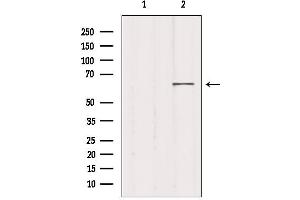 Western blot analysis of extracts from 293, using MED26 Antibody. (MED26 antibody  (N-Term))