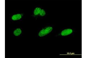 Immunofluorescence of monoclonal antibody to CDC2L2 on HeLa cell. (Cyclin-Dependent Kinase 11A (CDK11A) (AA 681-780) antibody)
