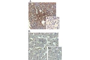 Immunohistochemical staining of human tissue using anti-ANGPTL4 (human), mAb (Kairos-1)  at 1:500 dilution. (ANGPTL4 antibody)