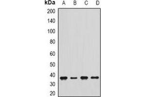Western blot analysis of delta-Sarcoglycan expression in Jurkat (A), THP1 (B), mouse skeletal muscle (C), rat heart (D) whole cell lysates. (SGCD antibody)