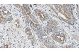 ABIN6276497 at 1/100 staining Human prostate tissue by IHC-P. (AMBRA1 antibody  (C-Term))
