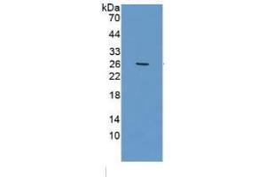 WB of Protein Standard: different control antibodies against Highly purified E. (GSTA1 ELISA Kit)