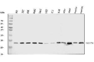 Western blot analysis of NDUFB8 using anti-NDUFB8 antibody (ABIN7599048).