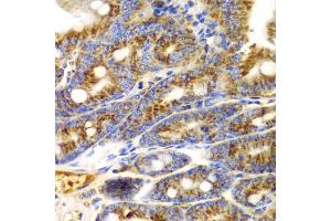 Immunohistochemistry of paraffin-embedded mouse Intestine using TNFSF11 antibody (ABIN6290161) at dilution of 1:100 (40x lens). (RANKL antibody)