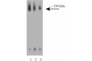 Western blot analysis of CD100 on a Jurkat cell lysate (Human T-cell leukemia, ATCC TIB-152). (SEMA4D/CD100 antibody  (AA 721-861))