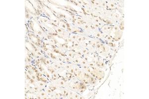Immunohistochemistry of paraffin-embedded mouse stomach using SOCS1 Rabbit mAb (ABIN7270640) at dilution of 1:100 (40x lens).