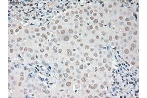 Immunohistochemical staining of paraffin-embedded liver tissue using anti-VEGFmouse monoclonal antibody. (VEGF antibody  (AA 27-233))