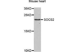 Western blot analysis of extracts of mouse heart, using SOCS2 antibody. (SOCS2 antibody)