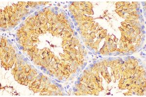 Immunohistochemistry (Paraffin-embedded Sections) (IHC (p)) image for anti-Lactate Dehydrogenase C (LDHC) antibody (ABIN7234324)