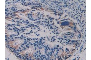 Used in DAB staining on fromalin fixed paraffin- embedded human liver tissue